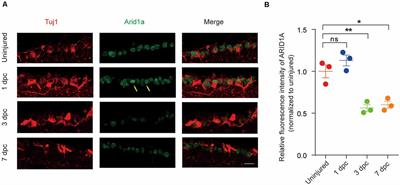 Loss of Arid1a Promotes Neuronal Survival Following Optic Nerve Injury
